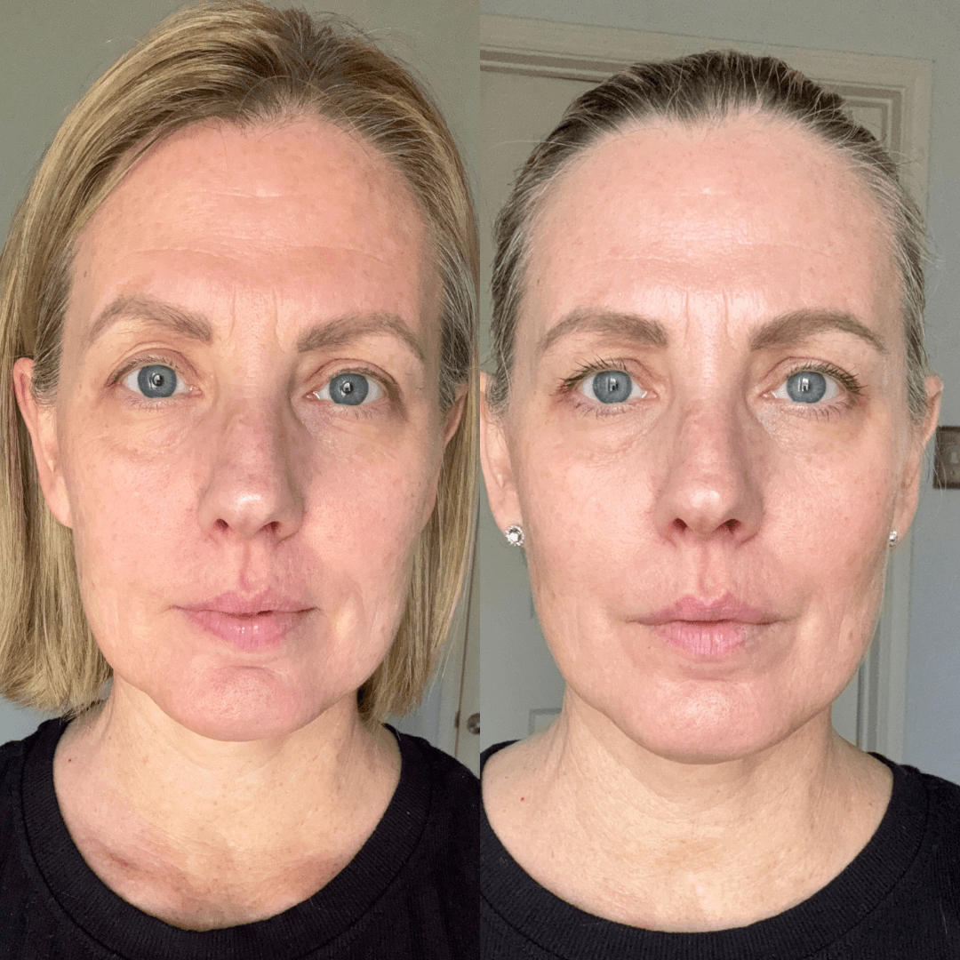 Tracy before and after using Vive